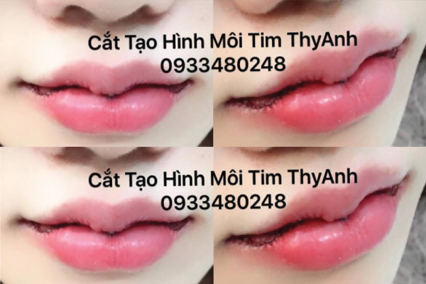 THYANH BEAUTY CENTER